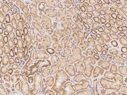 TBC1D14 Antibody, Novus Biologicals:Antibodies:Primary Antibodies