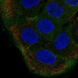TBC1D2 Rabbit anti-Human, Polyclonal, Novus Biologicals:Antibodies:Primary