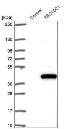 TBC1D21 Antibody, Novus Biologicals 25 &mu;L | Buy Online | Novus Biologicals | Fisher Scientific