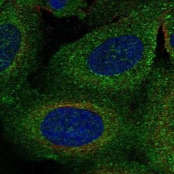 TBC1D2B Antibody, Novus Biologicals 25ul; Unconjugated:Antibodies, Polyclonal