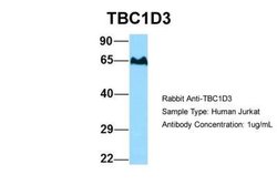 TBC1D3 Antibody, Novus Biologicals 100 &mu;L; Unconjugated:Antibodies,