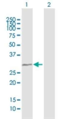 TBC1D7 Antibody, Novus Biologicals 0.05 mg | Buy Online | Novus Biologicals | Fisher Scientific