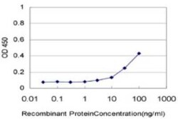 TBC1D8 Antibody (1A12), Novus Biologicals 0.1 mg | Buy Online | Novus Biologicals | Fisher Scientific