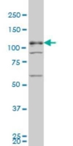 TBC1D8 Antibody (1A12), Novus Biologicals 0.1 mg | Buy Online | Novus Biologicals | Fisher Scientific