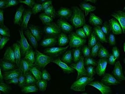 TBCA Antibody, Novus Biologicals:Anticorps:Anticorps primaires