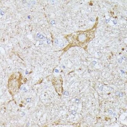 TBCA Antibody - Azide and BSA Free, Novus Biologicals:Anticorps:Anticorps