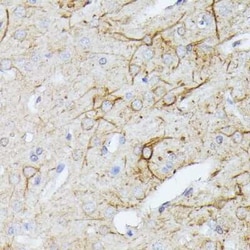 TBCA Antibody - Azide and BSA Free, Novus Biologicals:Anticorps:Anticorps