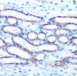 TBCCD1 Antibody - Azide and BSA Free, Novus Biologicals 0.02 mL; Unconjugated:Antibodies,