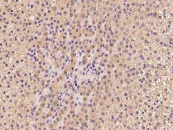 TBCE Antibody, Novus Biologicals 100 &mu;g; Unconjugated:Antibodies, Polyclonal