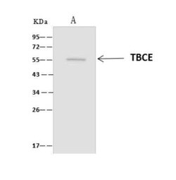 TBCE Antibody, Novus Biologicals 100 &mu;g; Unconjugated:Antibodies, Polyclonal