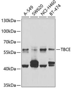TBCE Antibody - BSA Free, Novus Biologicals 0.02 mL, Unconjugated:Antibodies,