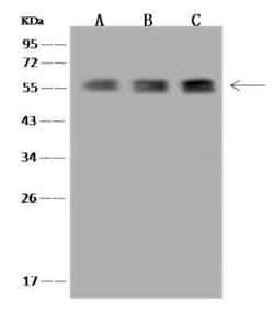TBCE Antibody, Novus Biologicals 100 &mu;g; Unconjugated:Antibodies, Polyclonal