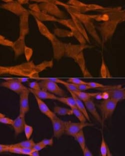 TBK1 Rabbit anti-Human, Mouse, Rat, Clone: 4G6C7, Novus Biologicals 100