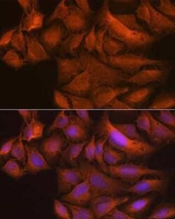 TBK1 Rabbit anti-Human, Mouse, Rat, Clone: 4G6C7, Novus Biologicals 100