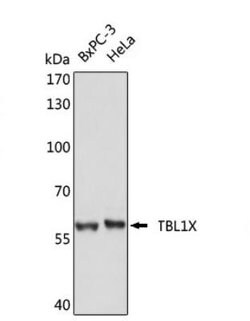 TBL1 Antibody, Novus Biologicals 50&mu;L; Unconjugated:Antibodies, Polyclonal