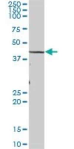 TBL2 Antibody, Novus Biologicals 0.05 mg | Buy Online | Novus Biologicals | Fisher Scientific