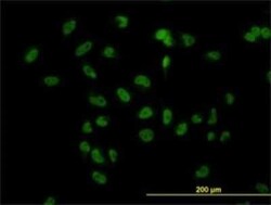 TBLR1 Antibody (3G7), Novus Biologicals 50 &mu;g | Buy Online | Novus Biologicals | Fisher Scientific