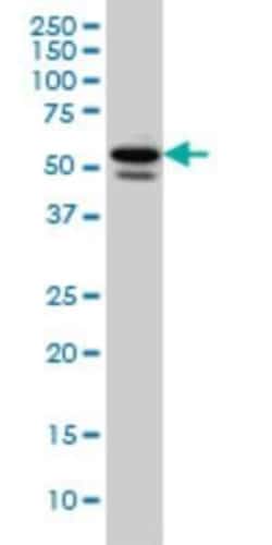 TBLR1 Antibody (3G7), Novus Biologicals 50 &mu;g | Buy Online | Novus Biologicals | Fisher Scientific