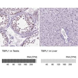 TBP like protein TLP Antibody, Novus Biologicals 25 &mu;L, Unconjugated:Antibodies,
