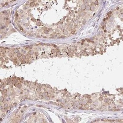 TBPL2 Antibody, Novus Biologicals 25 &mu;L, Unconjugated:Antibodies, Polyclonal