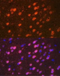 TBR1 Rabbit anti-Human, Mouse, Rat, Clone: 1U1K5, Novus Biologicals 20