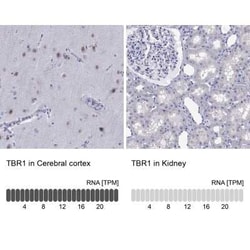 TBR1 Antibody, Novus Biologicals 100 &mu;g; Unconjugated:Antibodies, Polyclonal