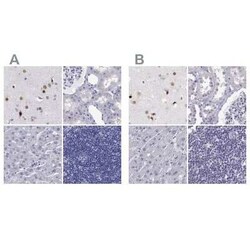 TBR1 Antibody, Novus Biologicals 100 &mu;g; Unconjugated:Antibodies, Polyclonal