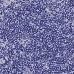 TBR1 Antibody, Novus Biologicals 100 &mu;g; Unconjugated:Antibodies, Polyclonal