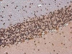 TBR1 Antibody, Novus Biologicals 100 &mu;g | Buy Online | Novus Biologicals | Fisher Scientific