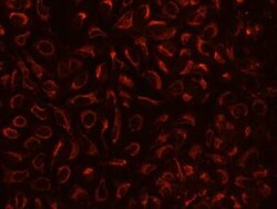 TBRG4 Antibody, Novus Biologicals 100 &mu;g, Unconjugated:Antibodies, Polyclonal