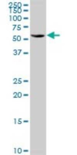 TBRG4 Antibody, Novus Biologicals 0.05 mg | Buy Online | Novus Biologicals | Fisher Scientific