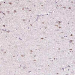 TBX15 Antibody, Novus Biologicals:Antibodies:Primary Antibodies