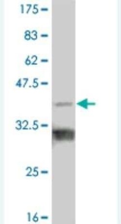 TBX18 Antibody (3D9), Novus Biologicals 0.1 mg | Buy Online | Novus Biologicals | Fisher Scientific