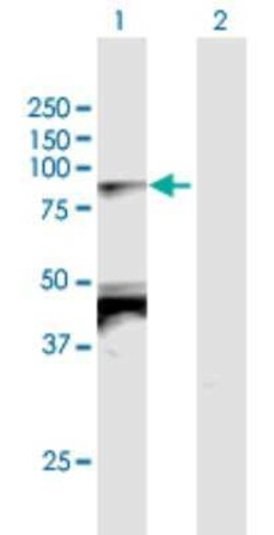 TBX2 Antibody, Novus Biologicals 0.05 mg; Unconjugated:Antibodies, Polyclonal