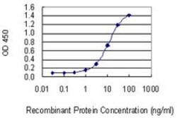 Novus Biologicals TBX22 Antibody (1A10), Novus Biologicals 0.1 mg | Buy Online | Novus Biologicals&trade; | Fisher Scientific