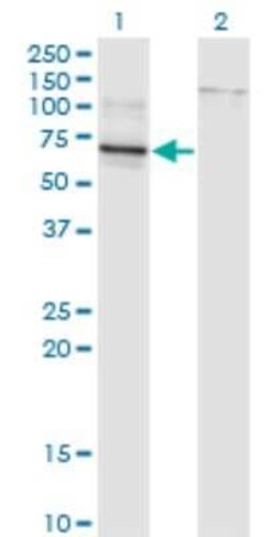 Novus Biologicals TBX22 Antibody (1A10), Novus Biologicals 0.1 mg | Buy Online | Novus Biologicals&trade; | Fisher Scientific