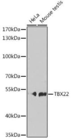 TBX22 Antibody - BSA Free, Novus Biologicals 0.02 mL; Unconjugated:Antibodies,