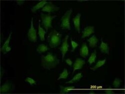 TBX3 Antibody (8H3), Novus Biologicals 0.1 mg | Buy Online | Novus Biologicals | Fisher Scientific