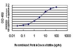 TBX3 Antibody (8H3), Novus Biologicals 0.1 mg | Buy Online | Novus Biologicals | Fisher Scientific