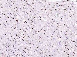 TBX5 Antibody, Novus Biologicals 100 &mu;g; Unconjugated:Antibodies, Polyclonal