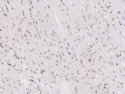 TBX5 Antibody, Novus Biologicals 100 &mu;g; Unconjugated:Antibodies, Polyclonal