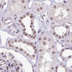 TC-PTP/PTPN2 Antibody, Novus Biologicals 25 &mu;L | Buy Online | Novus Biologicals | Fisher Scientific