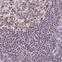 TC-PTP/PTPN2 Antibody, Novus Biologicals 25 &mu;L | Buy Online | Novus Biologicals | Fisher Scientific