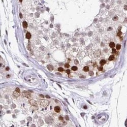 TC-PTP/PTPN2 Antibody, Novus Biologicals 25 &mu;L | Buy Online | Novus Biologicals | Fisher Scientific