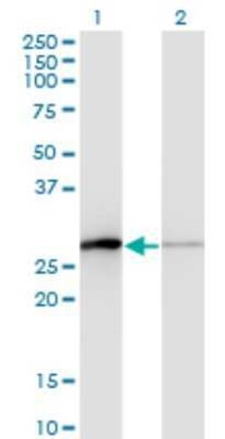 TCEAL1 Antibody (3B9), Novus Biologicals 0.1 mg | Buy Online | Novus Biologicals | Fisher Scientific