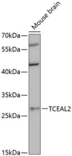 TCEAL2 Antibody - Azide and BSA Free, Novus Biologicals 0.1 mL; Unconjugated:Anticuerpos
