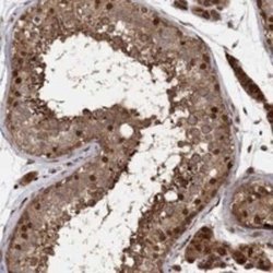 TCEB2 Rabbit anti-Human, Polyclonal, Novus Biologicals:Antibodies:Primary
