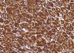 TCERG1L Antibody (05), Novus Biologicals 100 &mu;g; Unconjugated:Antibodies,