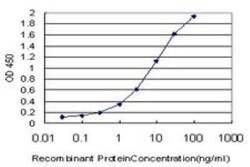 TCF19 Antibody (6D8), Novus Biologicals 0.1 mg | Buy Online | Novus Biologicals | Fisher Scientific