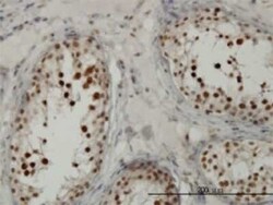 TCF19 Antibody (6D8), Novus Biologicals 0.1 mg | Buy Online | Novus Biologicals | Fisher Scientific